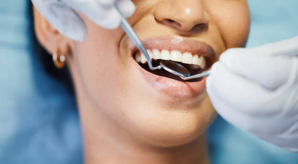 Best Broken or Cracked Tooth Emergency Dentist in Denver, CO